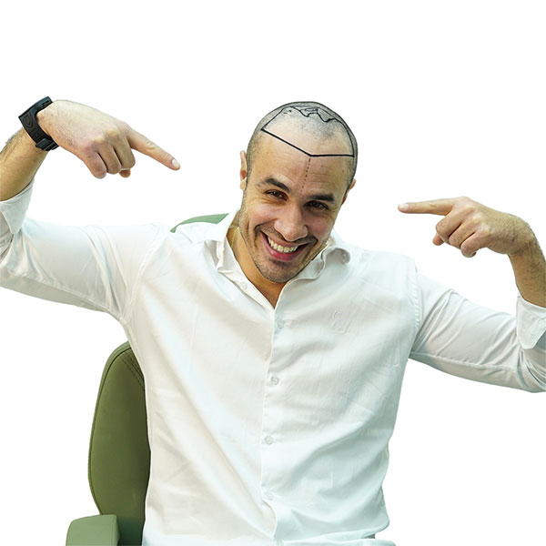 Medical Of Istanbul Hair Transplant in Turkey