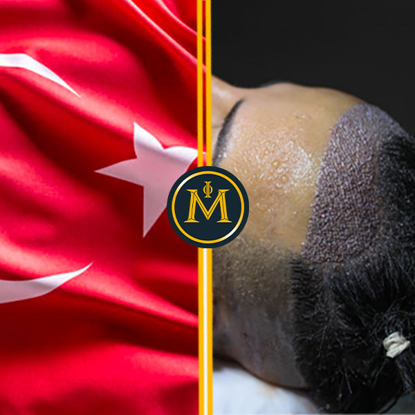 Turkey-Hair-Transplant