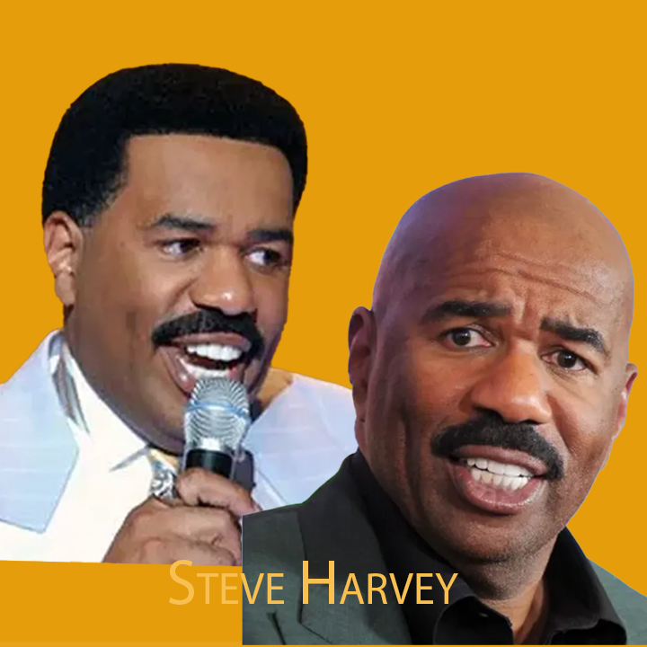 Steve Harvey Hair Transplant : A Journey of Transformation 2024