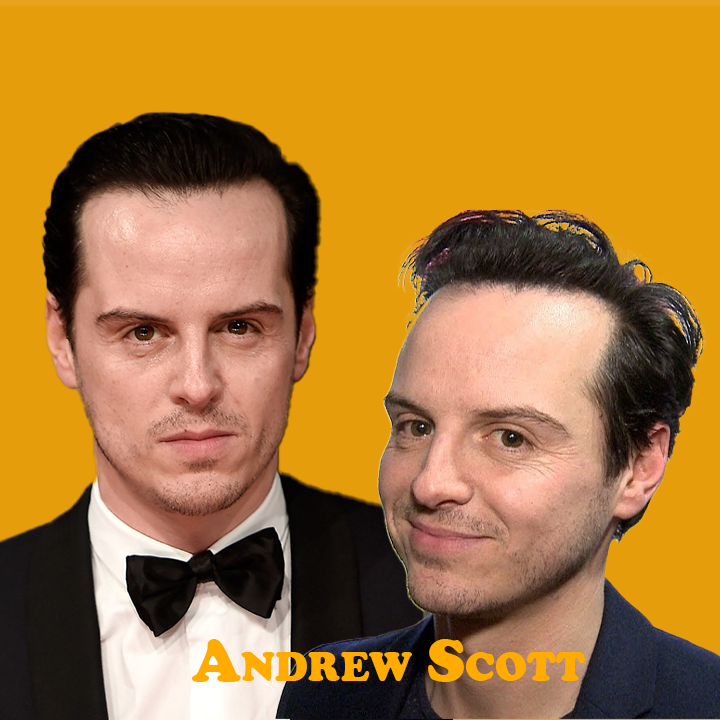 Andrew Scott Hair Transplant: A Journey of Transformation 2024