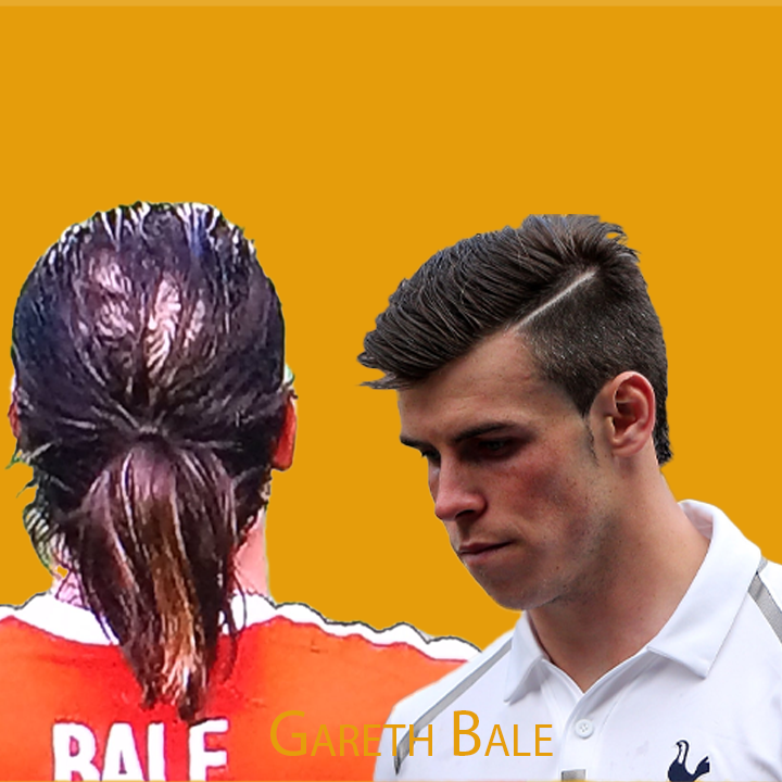 Gareth Bale Hair Transplant: A Journey of Transformation 2024
