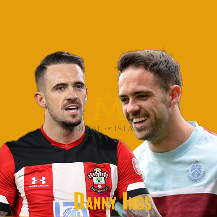Danny Ings Hair Transplant A Journey of Transformation​