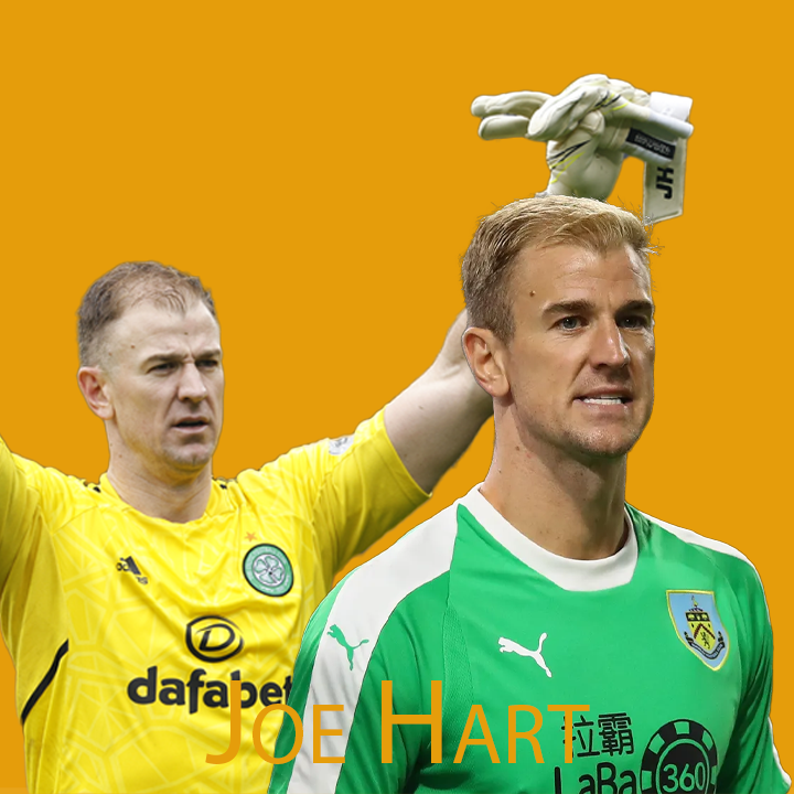 Joe Hart Hair Transplant A Journey Of Transformation 2024 Joe Hart Hair Transplant A Journey Of Transformation 2024
