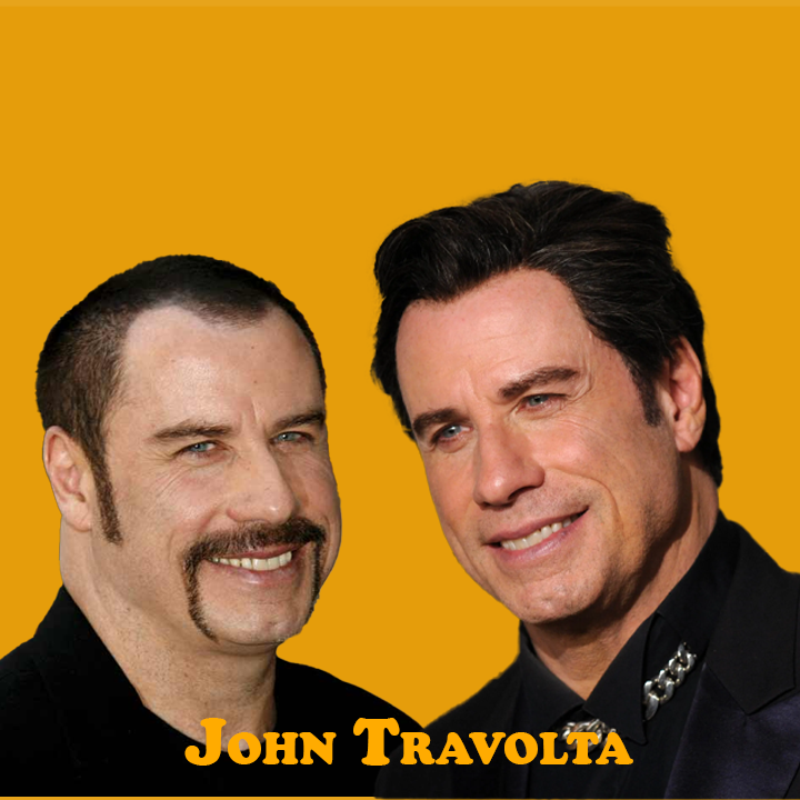 John Travolta Hair Transplant: A Journey of Transformation 2024