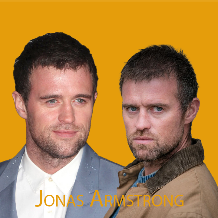 Jonas Armstrong Hair Transplant: A Journey of Transformation 2024
