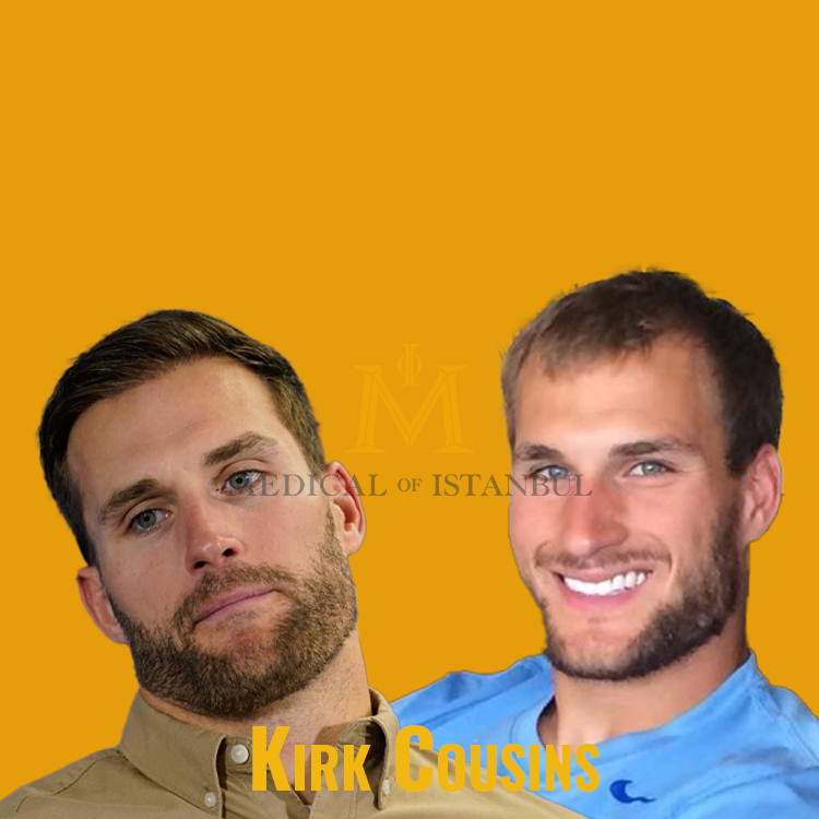 Kirk Cousins Hair Transplant A Journey of Transformation​