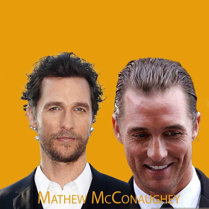 Matthew McConaughey Hair Transplant A Journey of Transformation