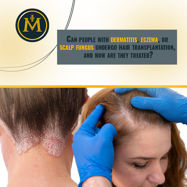 Can people with dermatitis, eczema, or scalp fungus undergo hair transplantation, and how are they treated?
