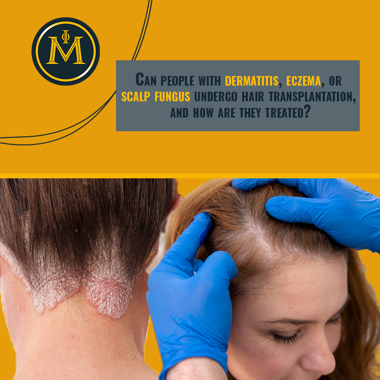 Can people with dermatitis, eczema, or scalp fungus undergo hair transplantation?