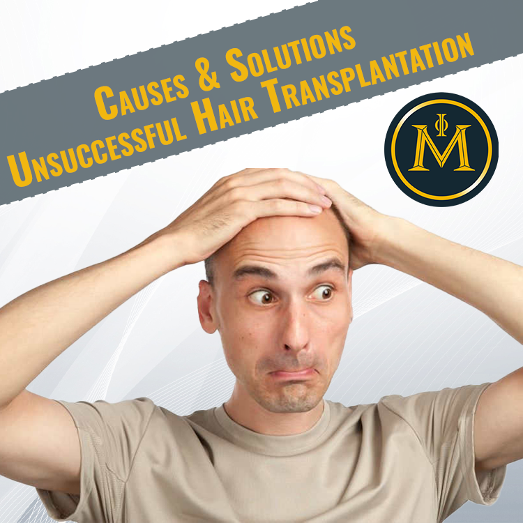 What are the Causes And Solutions Of Unsuccessful Hair Transplantation?