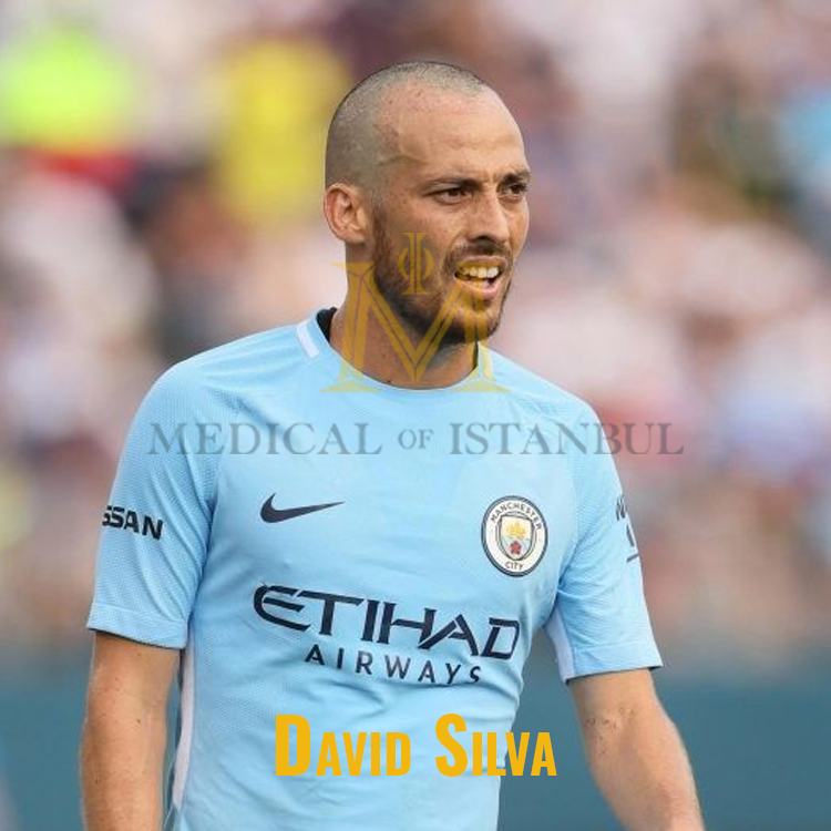 David Silva Hair Transplant A Journey of Transformation​