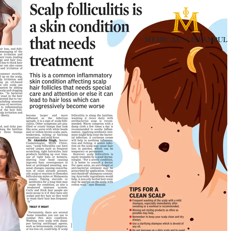 Folliculitis on Scalp After Hair Transplantation