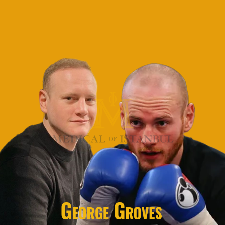 George Groves Hair Transplant A Journey of Transformation​
