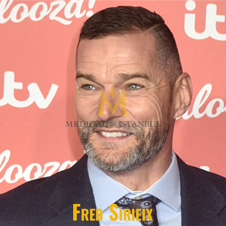 Fred Sirieix Hair Transplant Journey