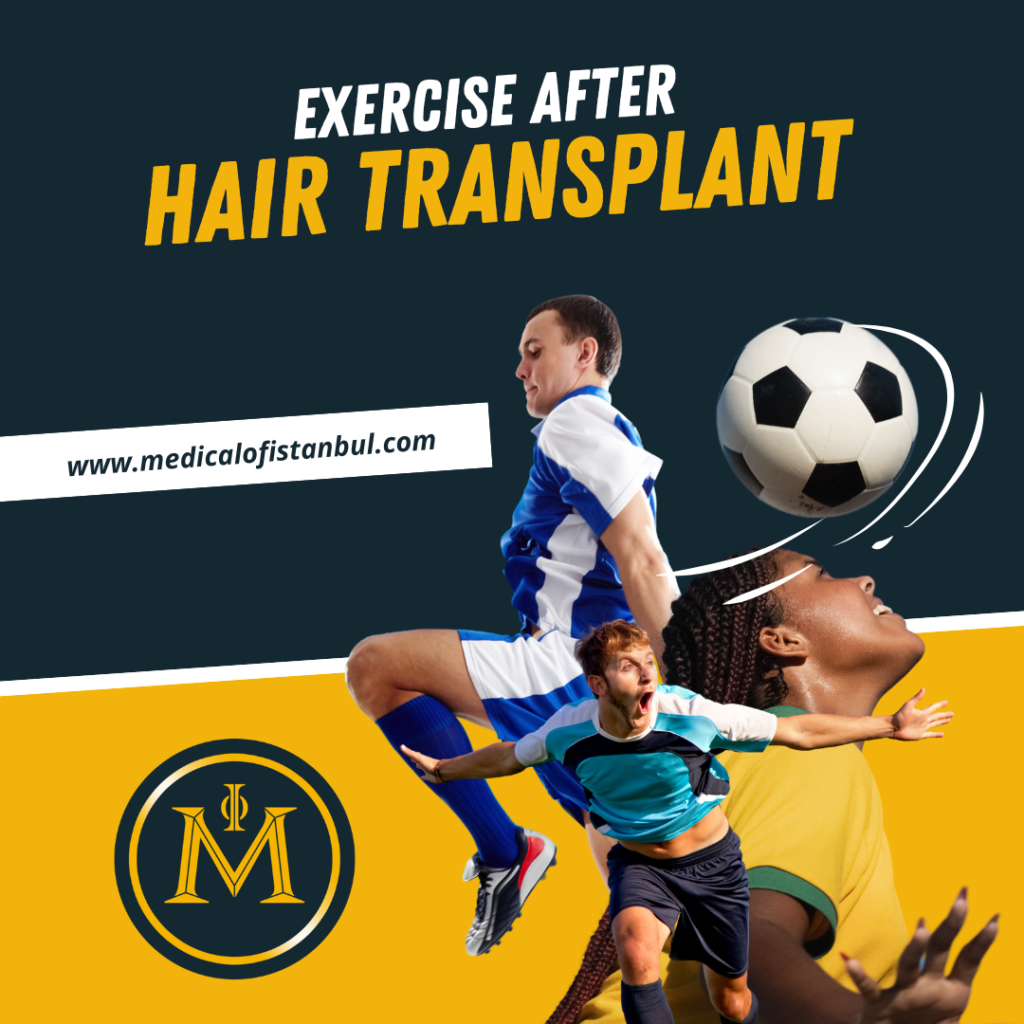 Exercise After Hair Transplant