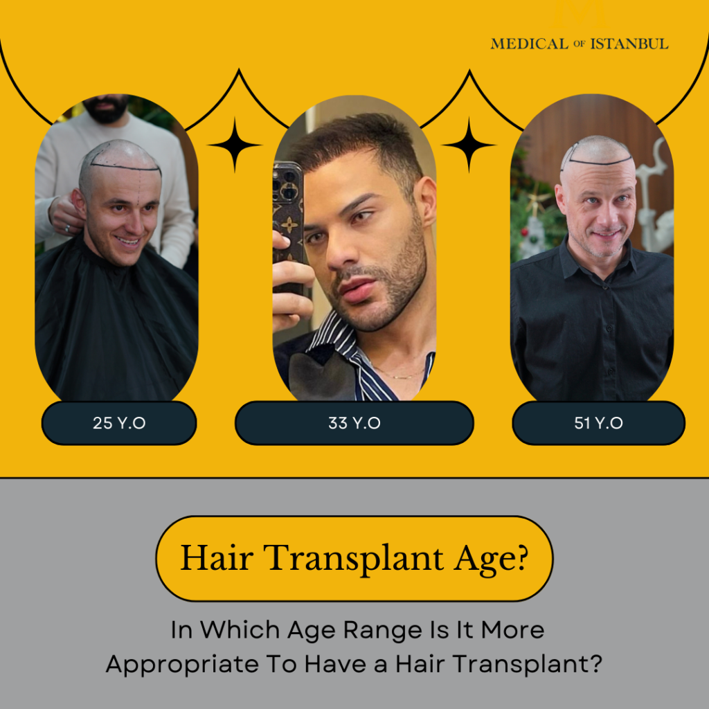 In Which Age Is It Appropriate To Have a Hair Transplant?