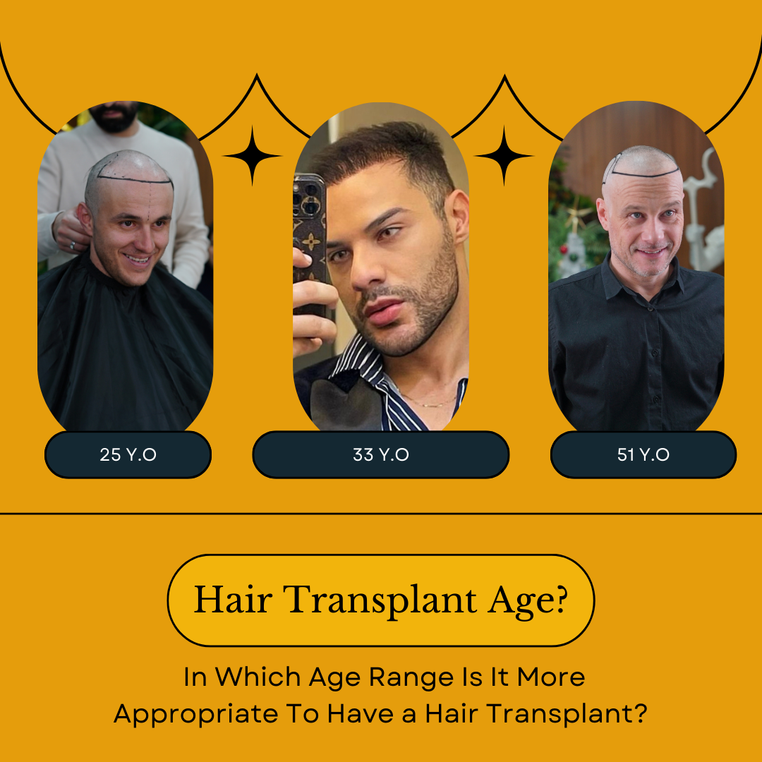 In Which Age Is It Appropriate To Have a Hair Transplant?