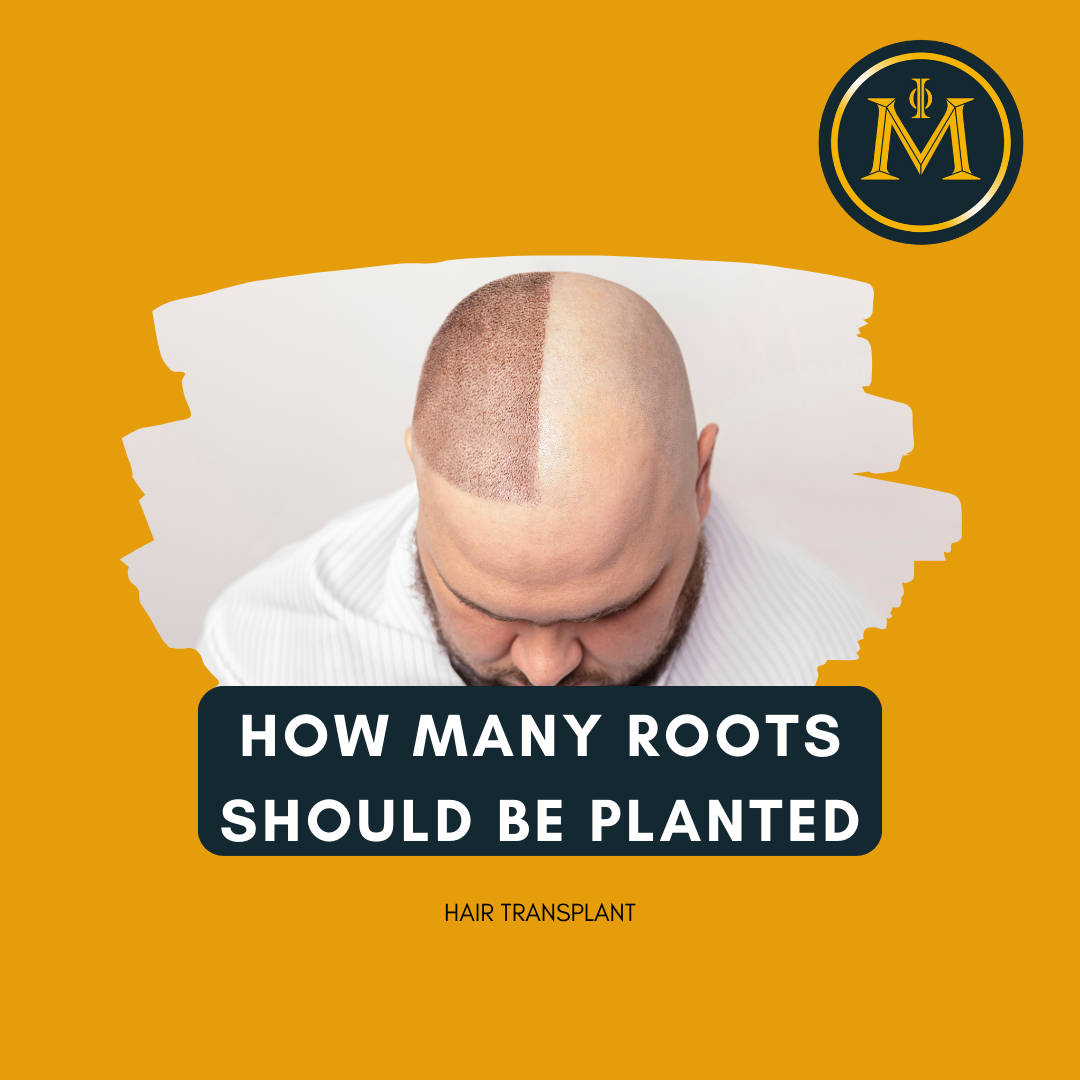 How Many Roots Should Be Planted Per Cm2 in Hair Transplantation?