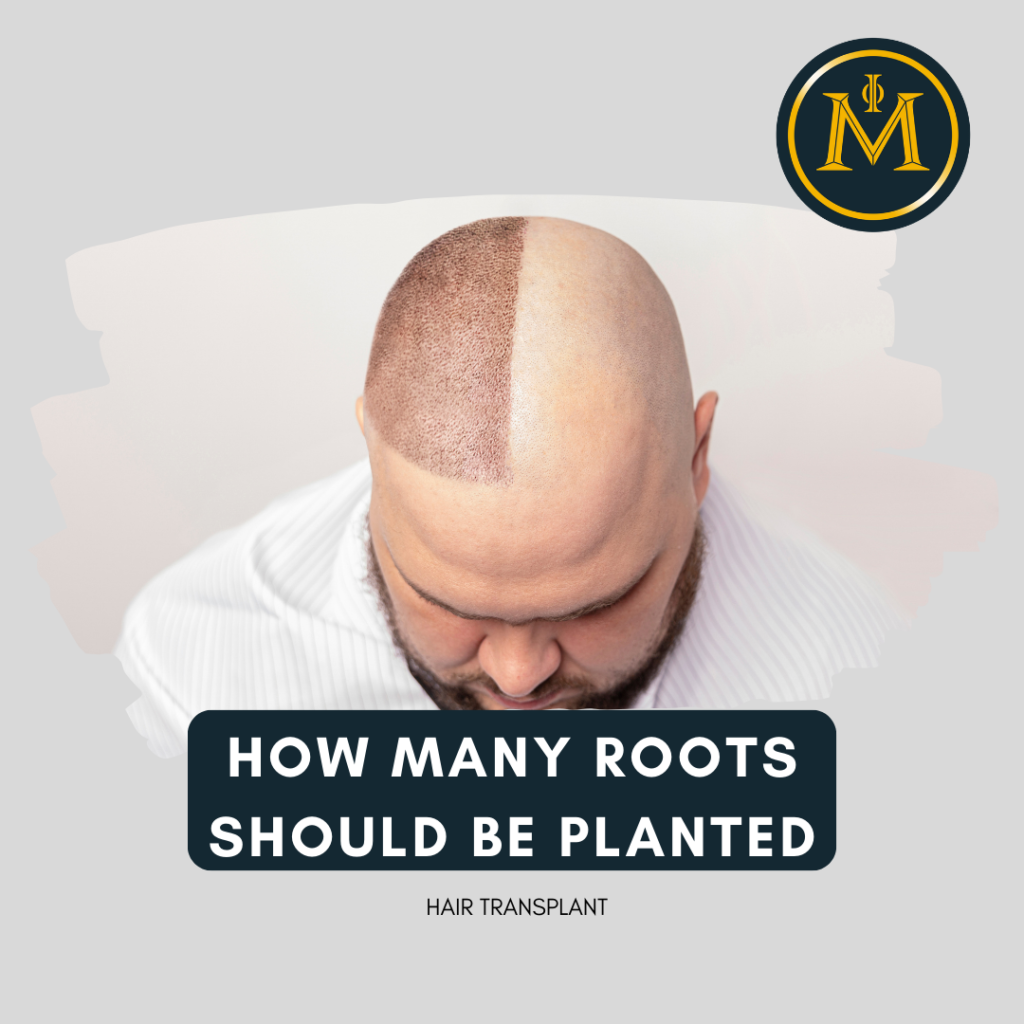 How Many Roots Should Be Planted Per Cm2 in Hair Transplantation?