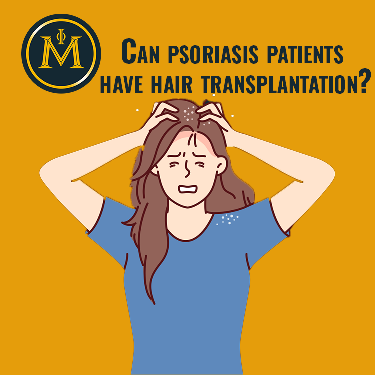 Can psoriasis patients have hair transplantation?