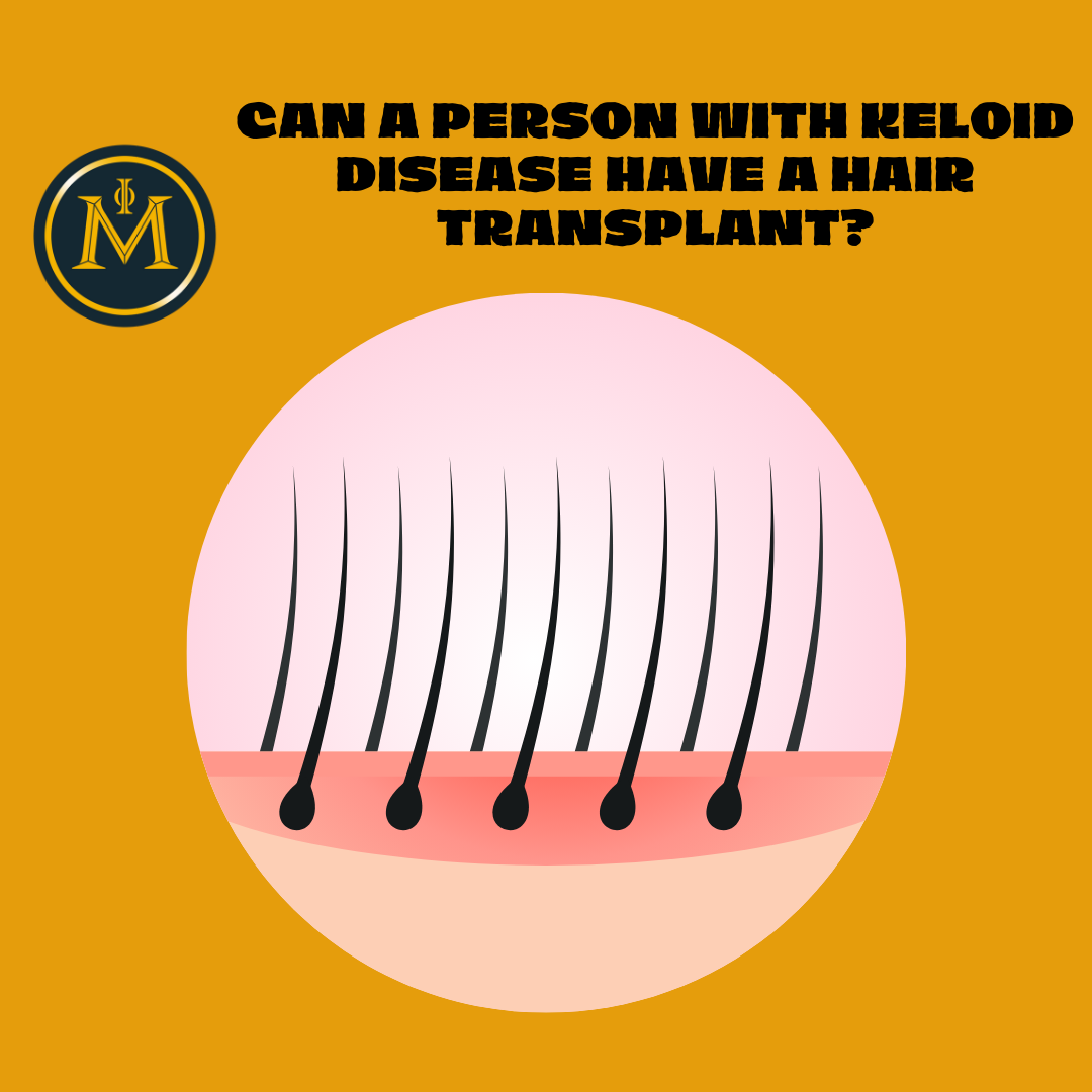 What is Keloid Disease and How Does It Affect Hair Transplant Candidacy?