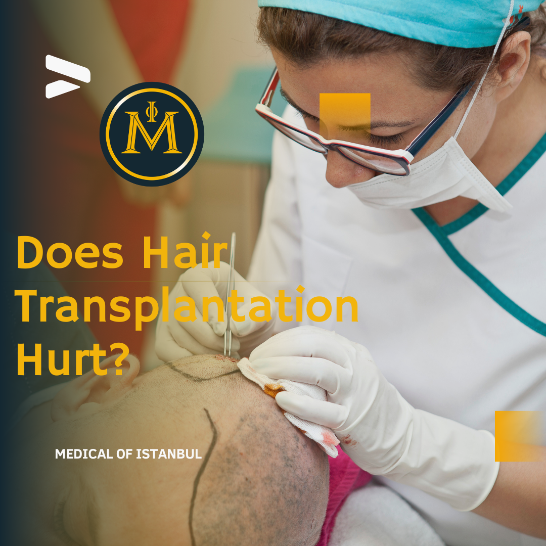 Does Hair Transplantation Hurt?