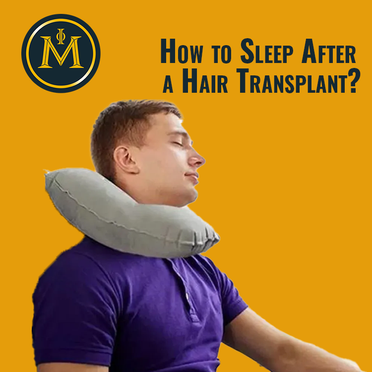 How to Sleep After a Hair Transplant?