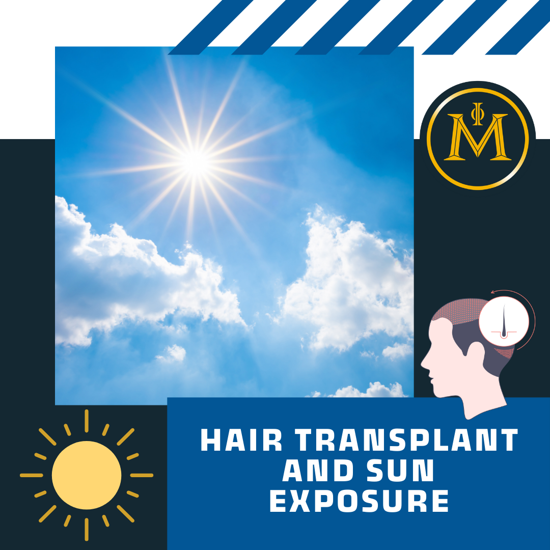 Hair Transplant and Sun Exposure