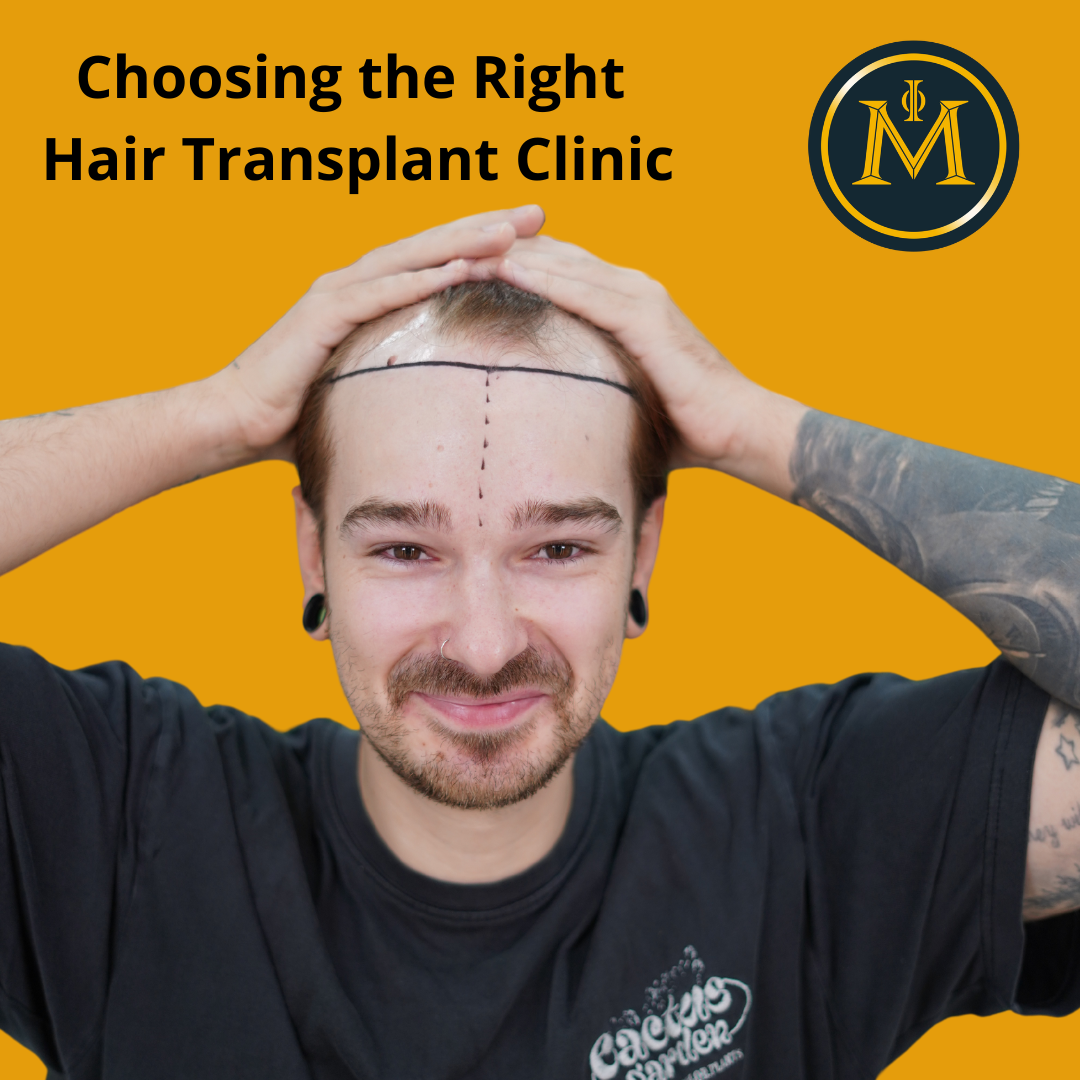 Choosing the Right Hair Transplant Clinic: Key Factors to Consider