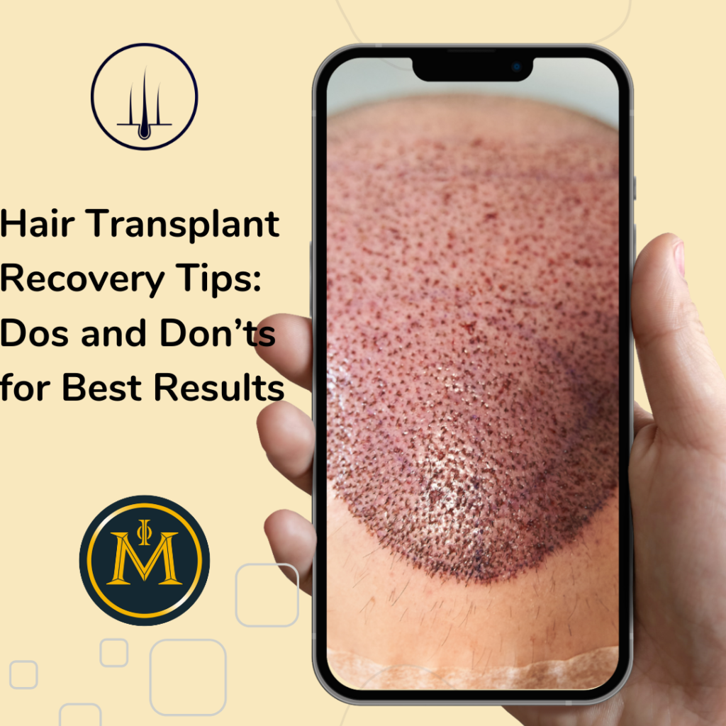 Hair Transplant Recovery Tips: Dos and Don’ts for Best Results