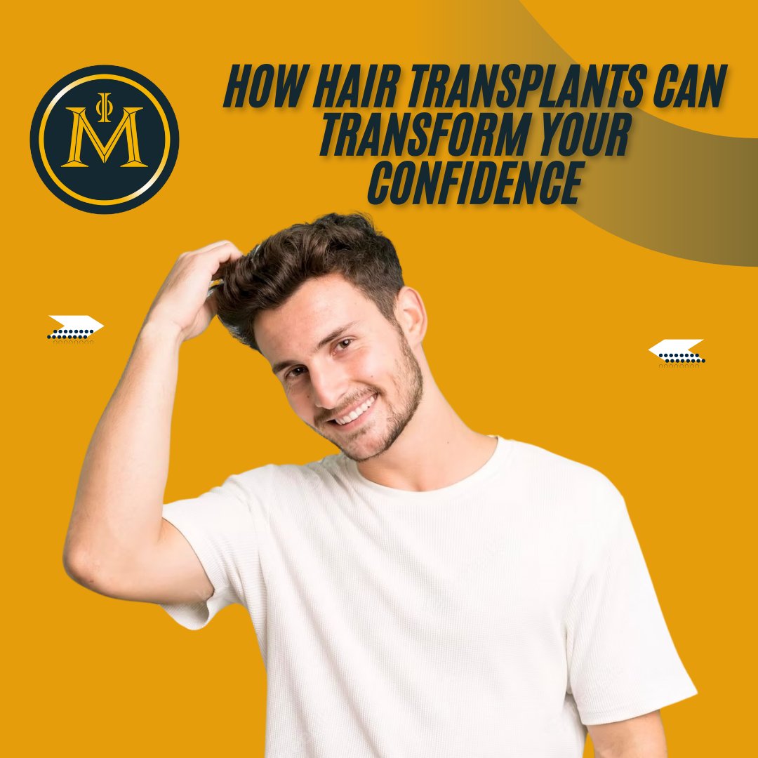 How Hair Transplants Can Transform Your Confidence​