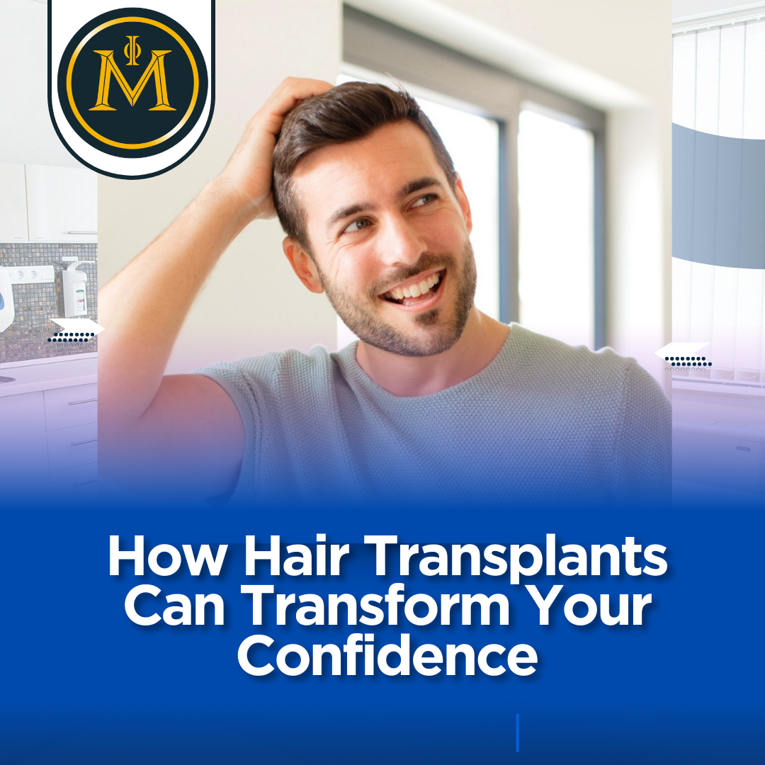 How Hair Transplants Can Transform Your Confidence