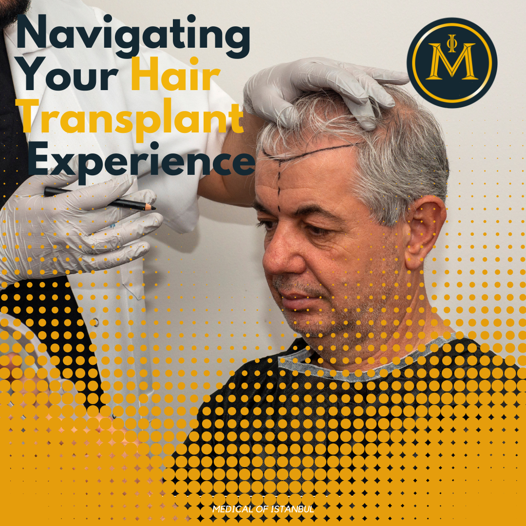 From Consultation to Recovery: Navigating Your Hair Transplant Experience