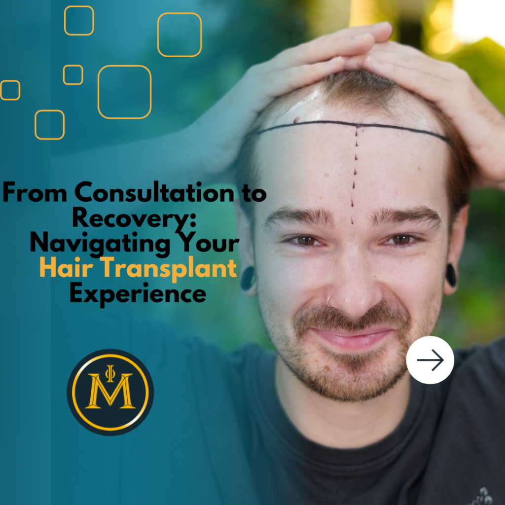 From Consultation to Recovery: Navigating Your Hair Transplant Experience