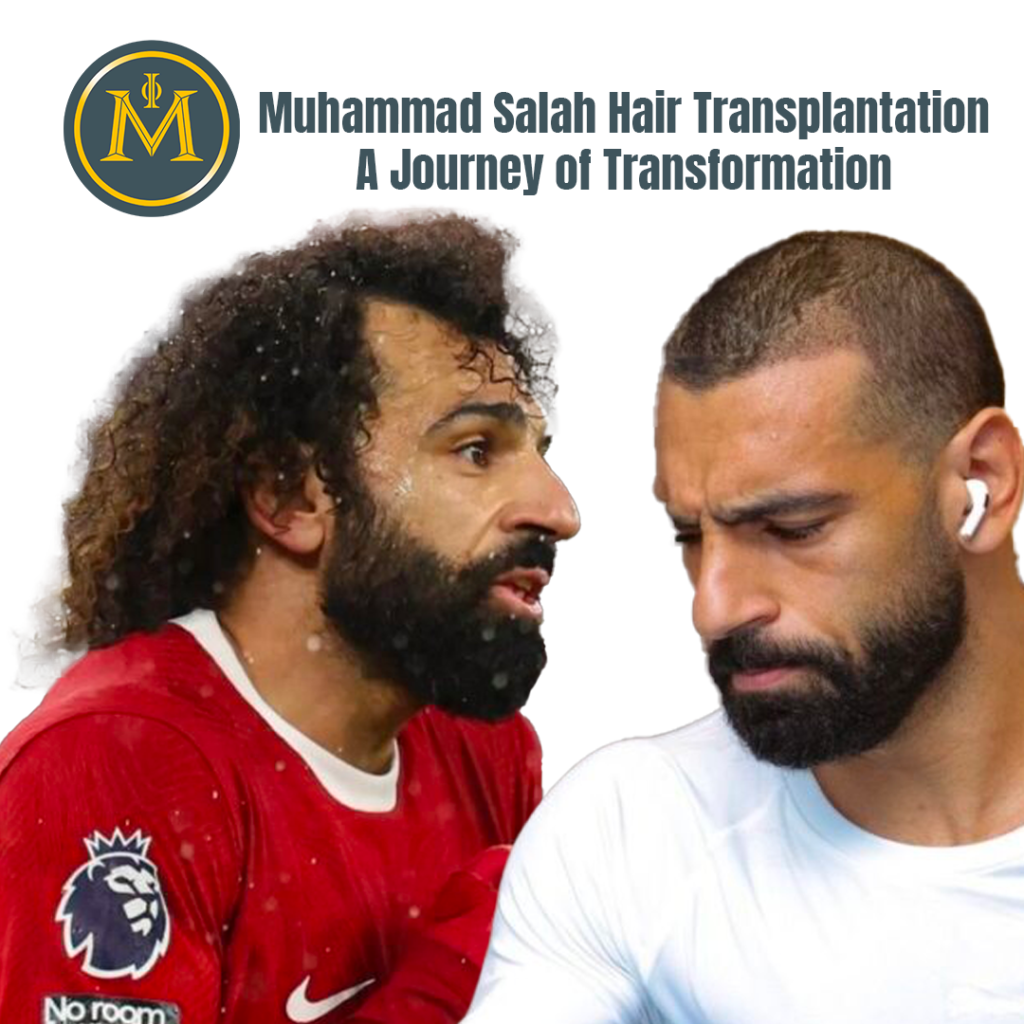 Muhammad Salah Hair Transplantation, A Journey of Transformation