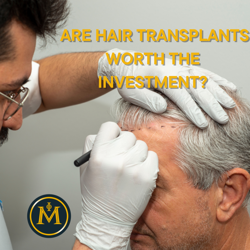 Breaking Down the Costs: Are Hair Transplants Worth the Investment?