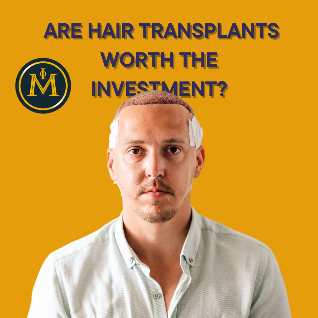 Breaking Down the Costs: Are Hair Transplants Worth the Investment?