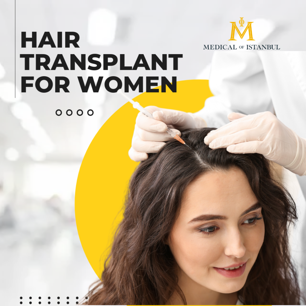 Hair Transplant for Women: Solutions for Female Hair Loss