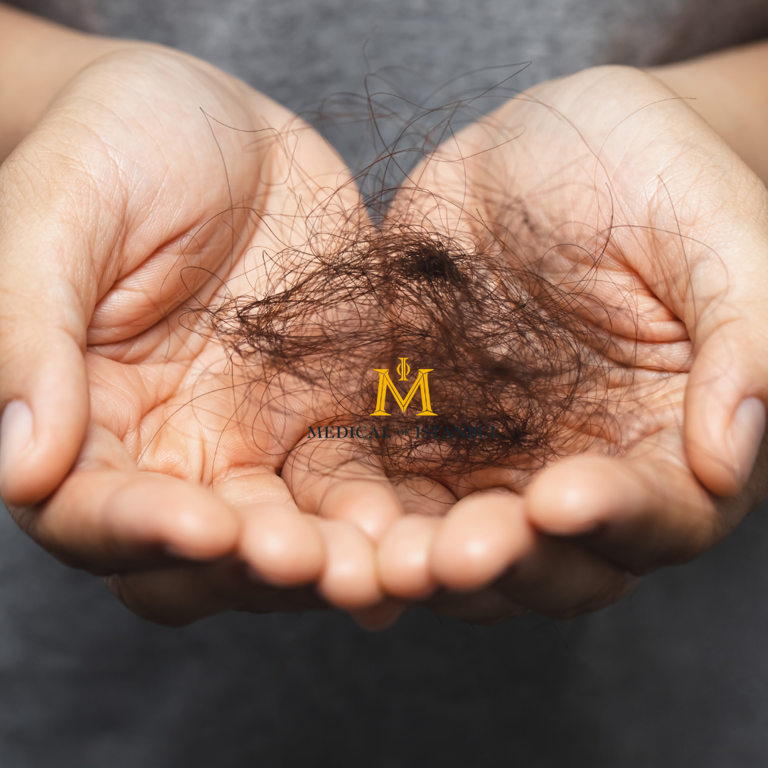 Hair Transplant for Women Solutions for Female Hair Loss