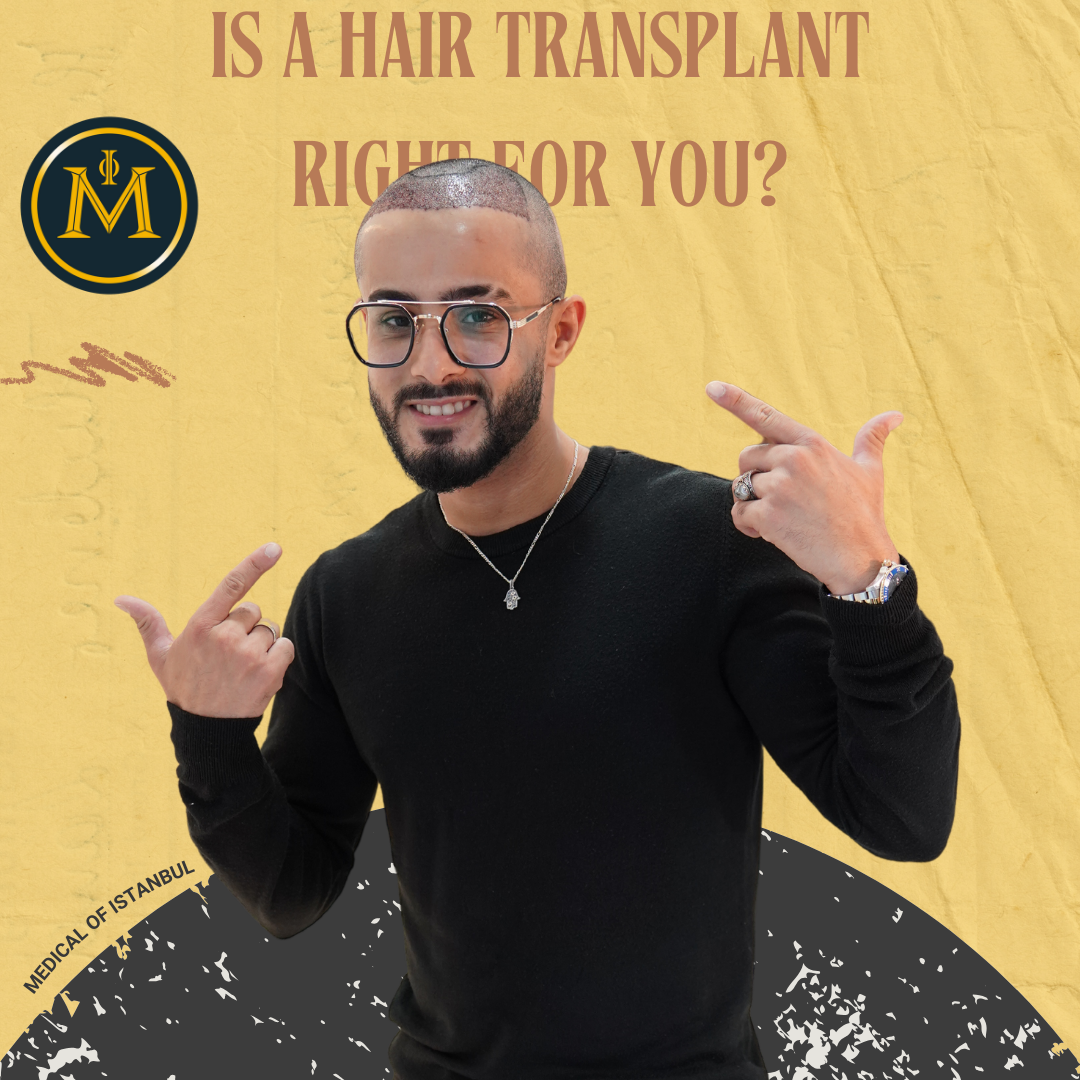 Is a Hair Transplant Right for You? A Look at Suitability, Results, and Alternatives