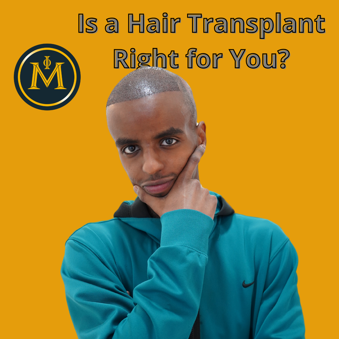 Is a Hair Transplant Right for You? A Look at Suitability, Results, and Alternatives