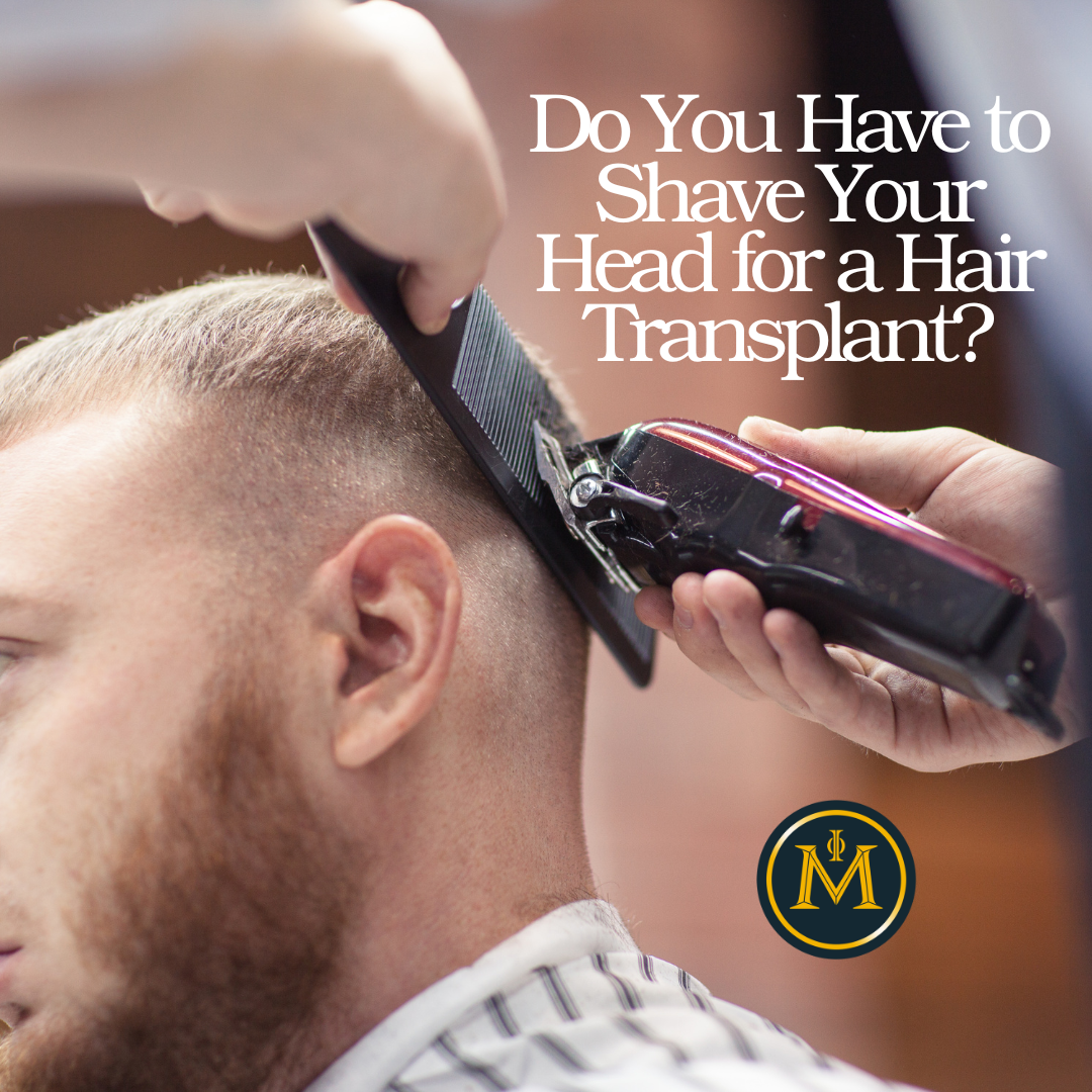 Do You Have to Shave Your Head for a Hair Transplant?