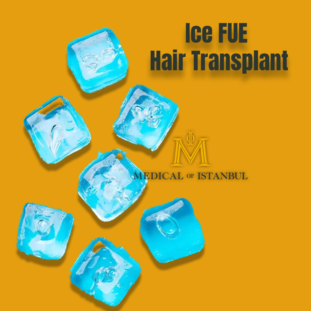 Ice FUE Hair Transplant