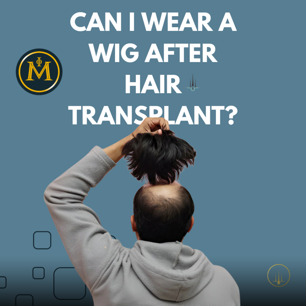 Can I Wear a Wig After Hair Transplant?