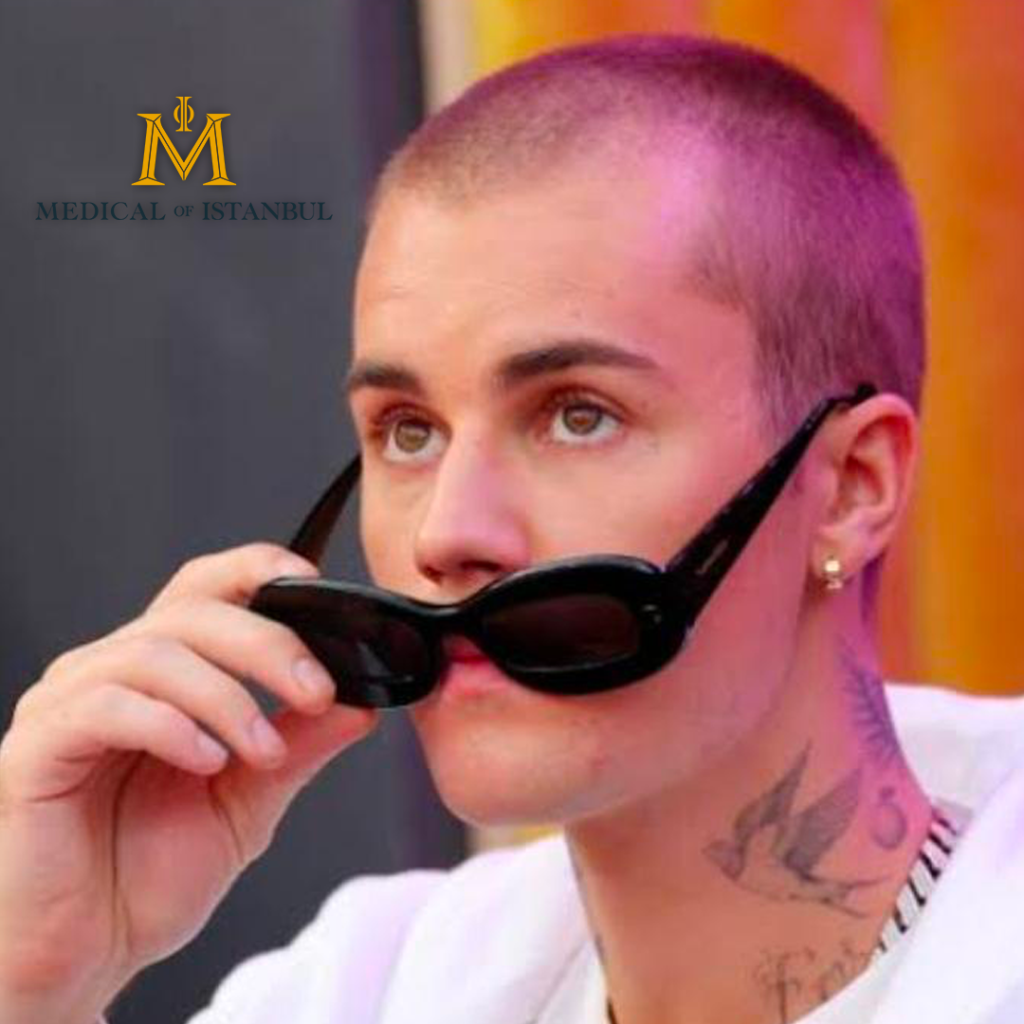 Justin Bieber Hair Transplantation Journey