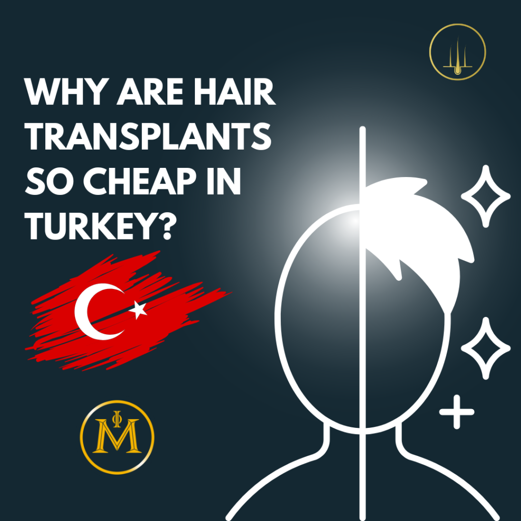 Why Are Hair Transplants So Cheap in Turkey?