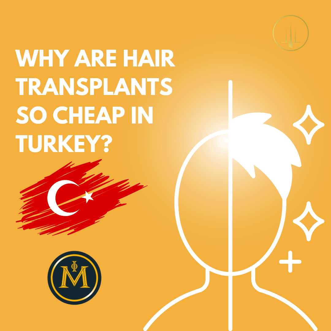 Why Are Hair Transplants So Cheap in Turkey?