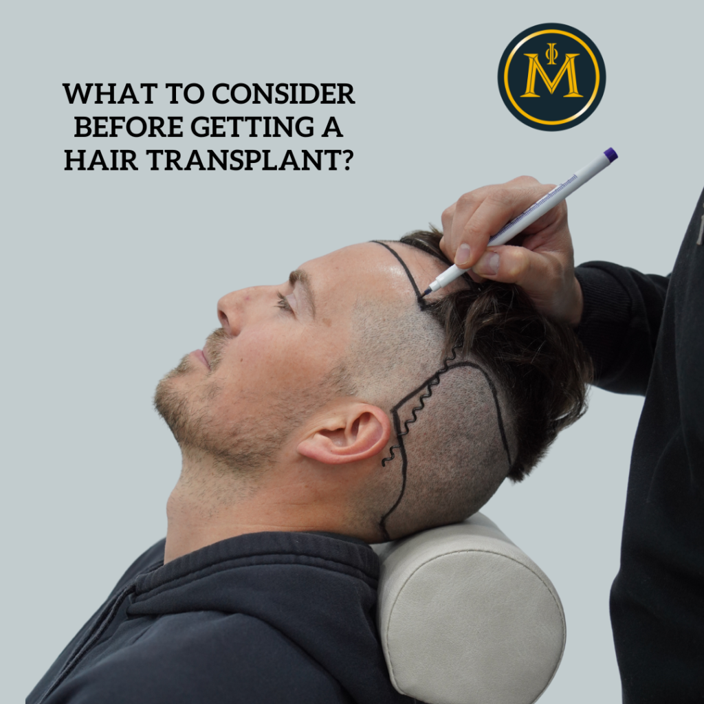 What to Consider Before Getting a Hair Transplant?