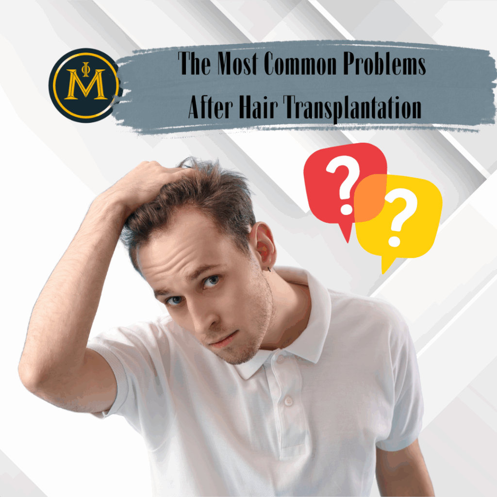 The Most Common Problems After Hair Transplantation