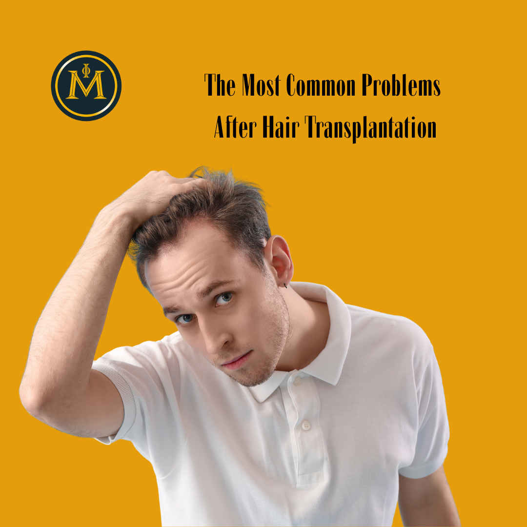 The Most Common Problems After Hair Transplantation